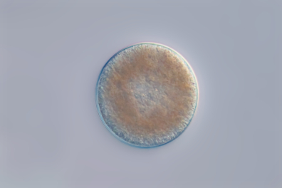 Ovule de Moule (Mytilus edulis) x125